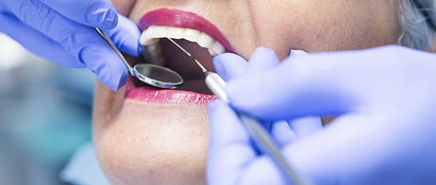 Best Emergency Gum Treatment in Corydon, IA